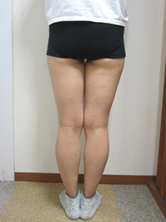 40代女性・足(ふともも・ふくらはぎ)