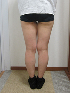 40代女性・足(ふともも・ふくらはぎ)